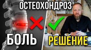 Остеохондроз что это такое и как лечить \ Симптомы остеохондроза