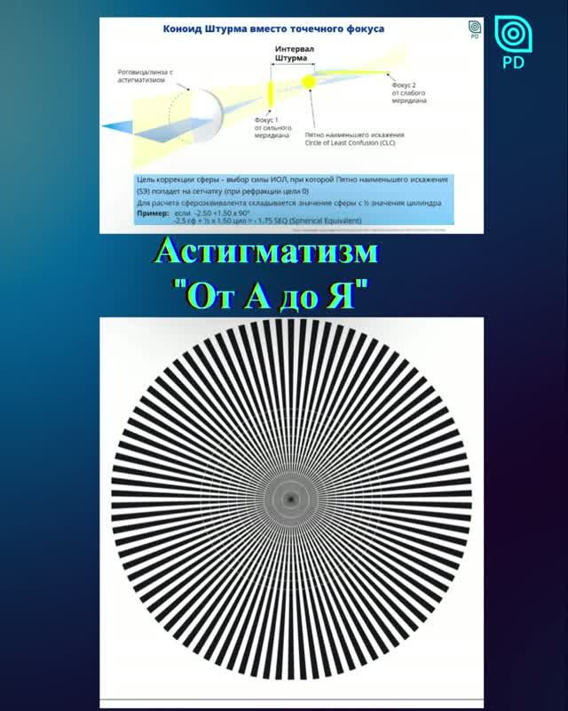 Менеджмент Астигматизма