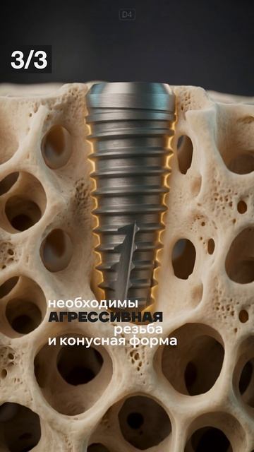 3_ключевых_фактора_для_приживления_имплантата (2) смотреть онлайн