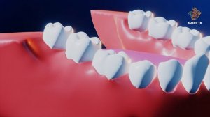 Ни өчен тешләрне чистартырга кирәк? | Гаҗәеп дөнья серләре. Кеше