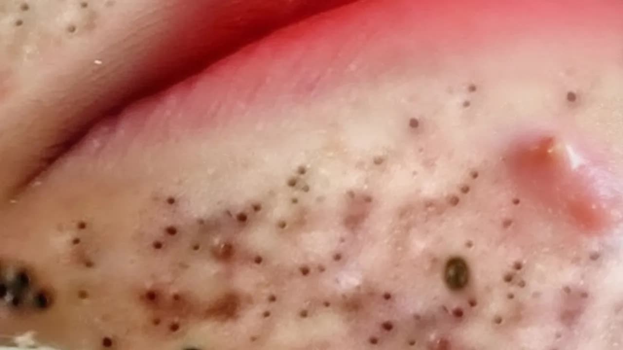 Успокаивающий уход за лицом для снятия стресса в спа-салоне: обретите внутренний покой смотреть онлайн