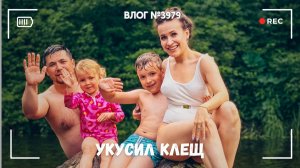 Вынимаем клещей из кошки | Купаемся на речке -  ВЛОГ №3979 - 21.06.26