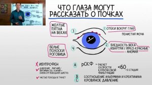 Проблемы с почками можно заметить ПО ГЛАЗАМ