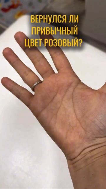 Проверка состояния сосудов смотреть онлайн