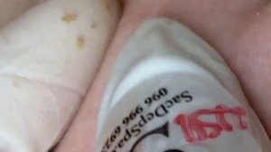 ГЛУБОКАЯ ЧИСТКА ЛИЦА ОТ ЧЁРНЫХ ТОЧЕК — ПОСМОТРИ ДО КОНЦА