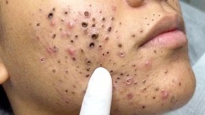 Нежное очищение лица для спокойного и счастливого идеального времени