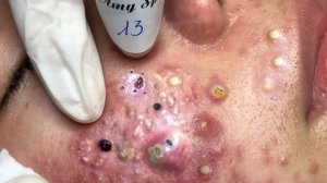 Успокаивающий уход за лицом для снятия стресса в спа-салоне класса люкс: обретите внутренний поко...