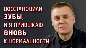 Восстановили зубной ряд пациенту с помощью имплантации и циркониевых коронок.