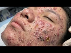 Нежное очищение лица для спокойного счастливого идеального времени