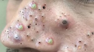 Чистка пор с расслабляющим массажем лица #467126