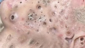 Достигните внутреннего покоя с помощью этих методов очищения лица #72346231