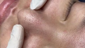 231 • Acne collection • АСМР • Relax Spa
