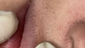238 • Acne collection • АСМР • Relax Spa