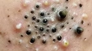 Успокаивающий уход за лицом для снятия стресса в спа-салоне класса люкс: обретение внутреннего по...