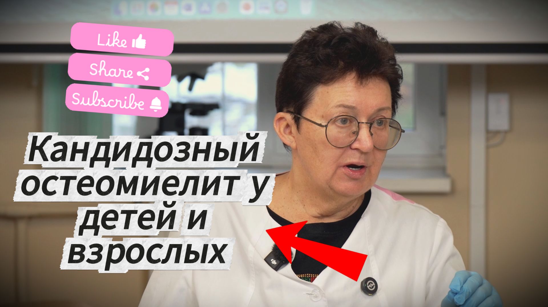 Кандидозный остеомиелит: почему у детей разрушаются суставы и позвоночник? смотреть онлайн