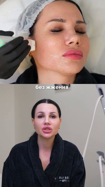 Отзыв пациентки после RF-лифтинга Volnewmer🤍