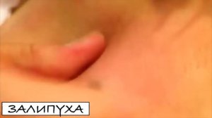 УГРЬ НА ТЕЛЕ! УДАЛЕНИЕ ЧЕРНОГО БОЛЬШОГО УГРЯ. БОЛЬШОЙ ПРЫЩ