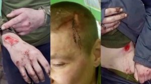 Добро пожаловать штурмовой полк украинских смертников «Скала«ВСУ,где с новобранцами творят страшное