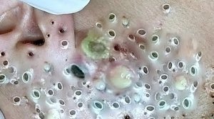 Успокаивающий уход за лицом для снятия стресса в спа-салоне: обретите внутренний покой