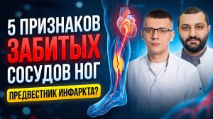 5 симптомов, что ваши сосуды ЗАБИТЫ холестерином! Срочный тест на атеросклероз