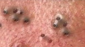 Нежное очищение лица для спокойного и счастливого времени