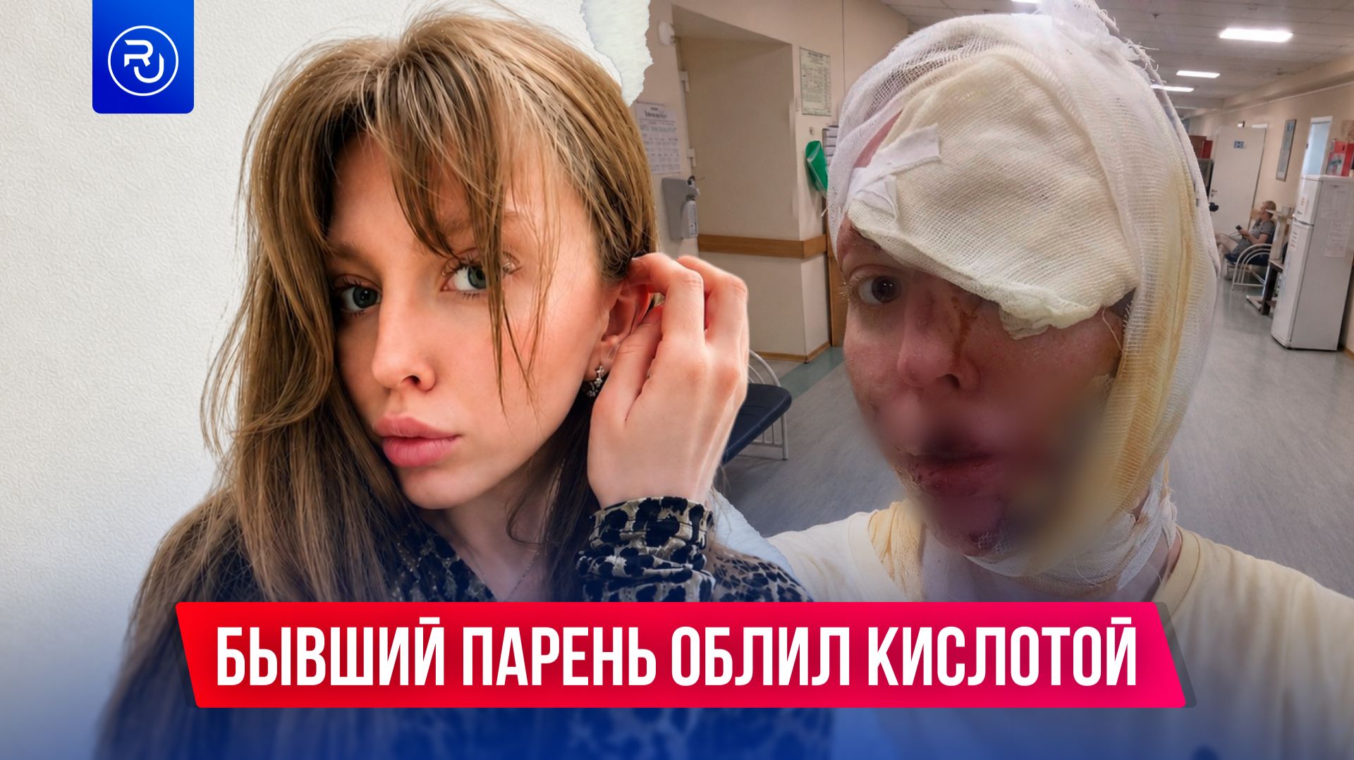Бывший парень облил ее кислотой смотреть онлайн