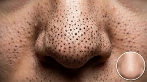 Корейский уход за кожей от черных точек | Глубокое очищение и уход за лицом