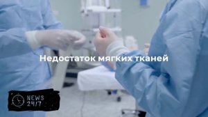 Врачи чудом спасли раздробленную при взрыве БПЛА руку медсестры в Луганске