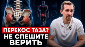 Можно ли исправить ПЕРЕКОС ТАЗА? Ответ врача