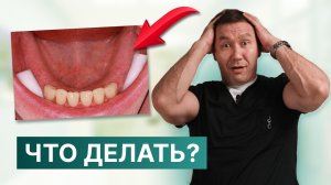 Остались только передние зубы – что делать?