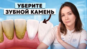 Как убрать ЗУБНОЙ КАМЕНЬ ДОМА? Самый простой способ