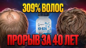 ПЕРВЫЙ ПРОРЫВ В ЛЕЧЕНИИ ВЫПАДЕНИЯ ВОЛОС ЗА 40 лет | ПИРИЛУТАМИД KX826