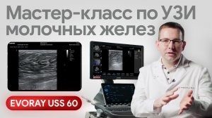 УЗИ молочных желез на EVORAY USS 60: поквадрантное сканирование