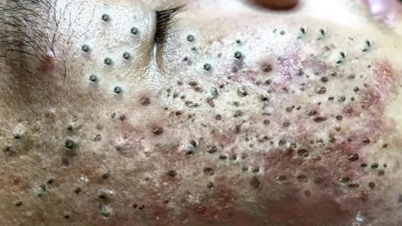 Успокаивающий уход за лицом для снятия стресса в спа-салоне — обретите внутренний покой #51016 смотреть онлайн