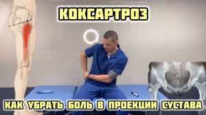 Как убрать боль в тазобедренном суставе?! Коксартроз. Самопомощь в домашних условиях. Миопрессура