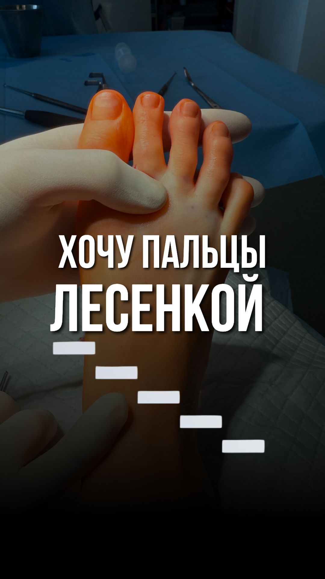 🪜Пальцы были разной длины: хочу пальцы лесенкой