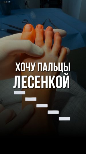 🪜Пальцы были разной длины: хочу пальцы лесенкой