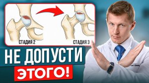 Коксартроз 2 степени: КАК ВЫЛЕЧИТЬ БЕЗ ОПЕРАЦИИ?