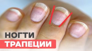 Как работать с ногтями трапециями? Лайфхаки для мастеров