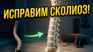 Комплекс упражнений при сколиозе 1-2 степени