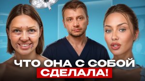 Стоила ли пластика Бони 20 МЛН НА САМОМ ДЕЛЕ? Разбор  пластического хирурга