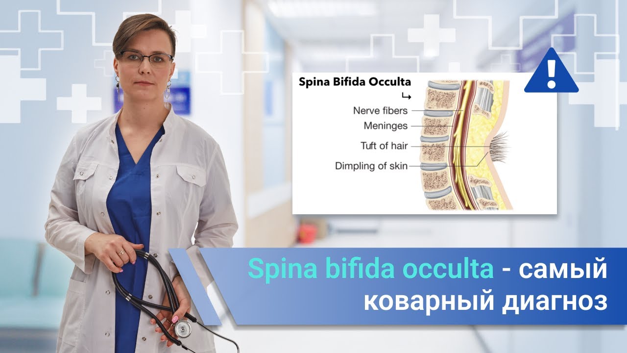 Spina bifida occulta - самая коварная патология/ смотреть онлайн