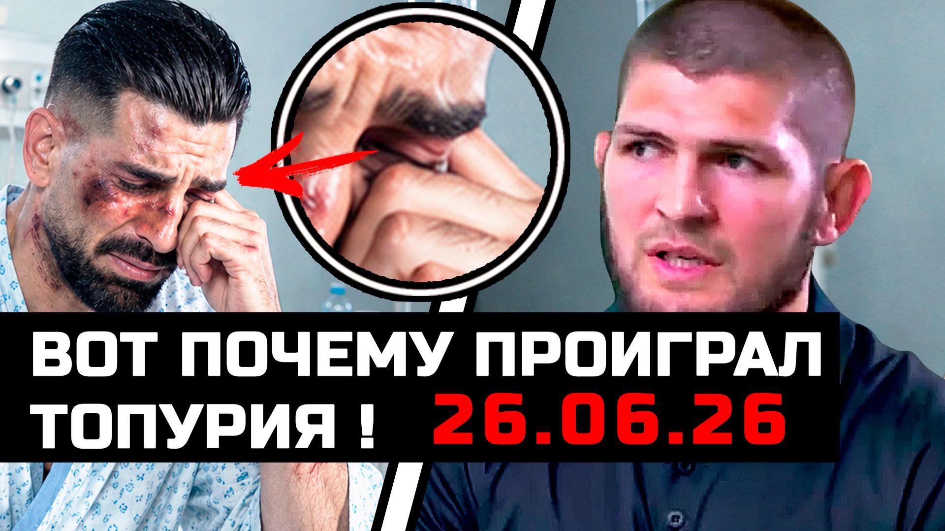 Вот это поворот! Вот почему Топурия проиграл! смотреть онлайн