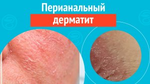 😦 Перианальный дерматит. Клинический случай №1701