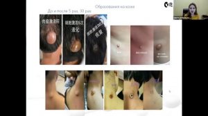 Активатор клеток прибор. Применение аппарата Активатора клеток