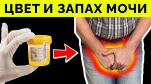 О чем расскажут ЦВЕТ и ЗАПАХ МОЧИ? Срочно проверьте свою МОЧУ! Сигналы серьезных болезней
