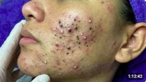 Нежное очищение лица для спокойного сна