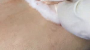 ВЫДАВЛИВАЕТ ПРЫЩИ И УГРИ. СОЧНОЕ РЕЛАКС ВИДЕО давить угри и прыщи