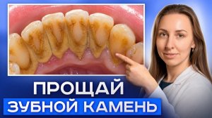 Убираем зубной камень за 5 минут. СЕКРЕТНЫЙ способ от стоматолога!
