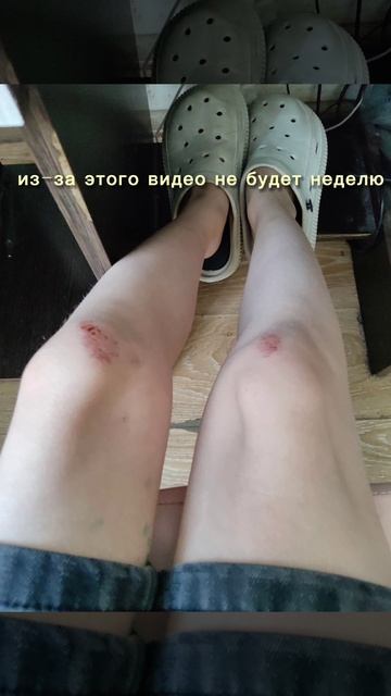 разбил 2 колена... смотреть онлайн